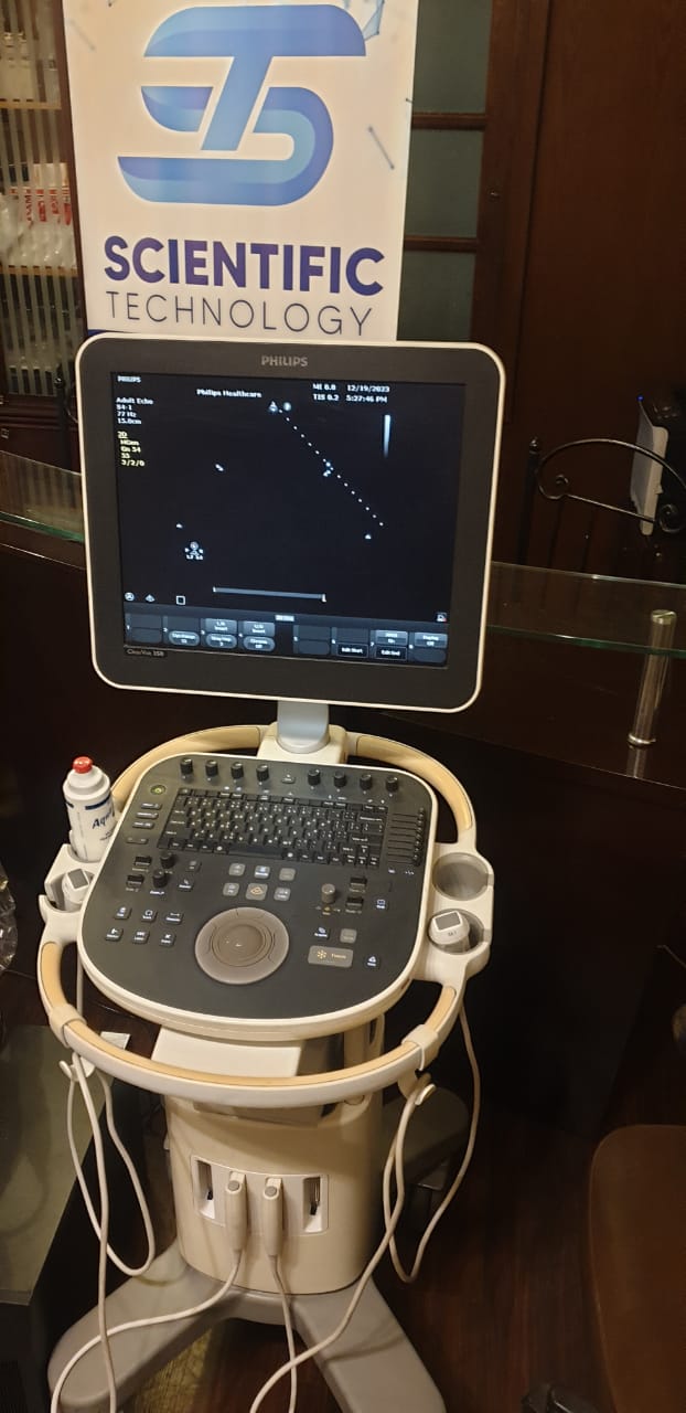 \Philips ultrasound clearvue 350