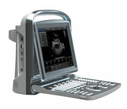 CHISON ECO 1 Vet Vet. Ultrasound